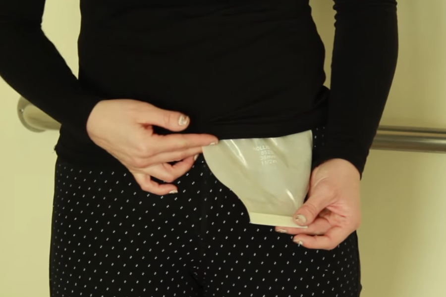 Tips for Stoma Care