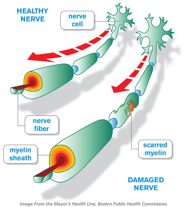 MS Nerve