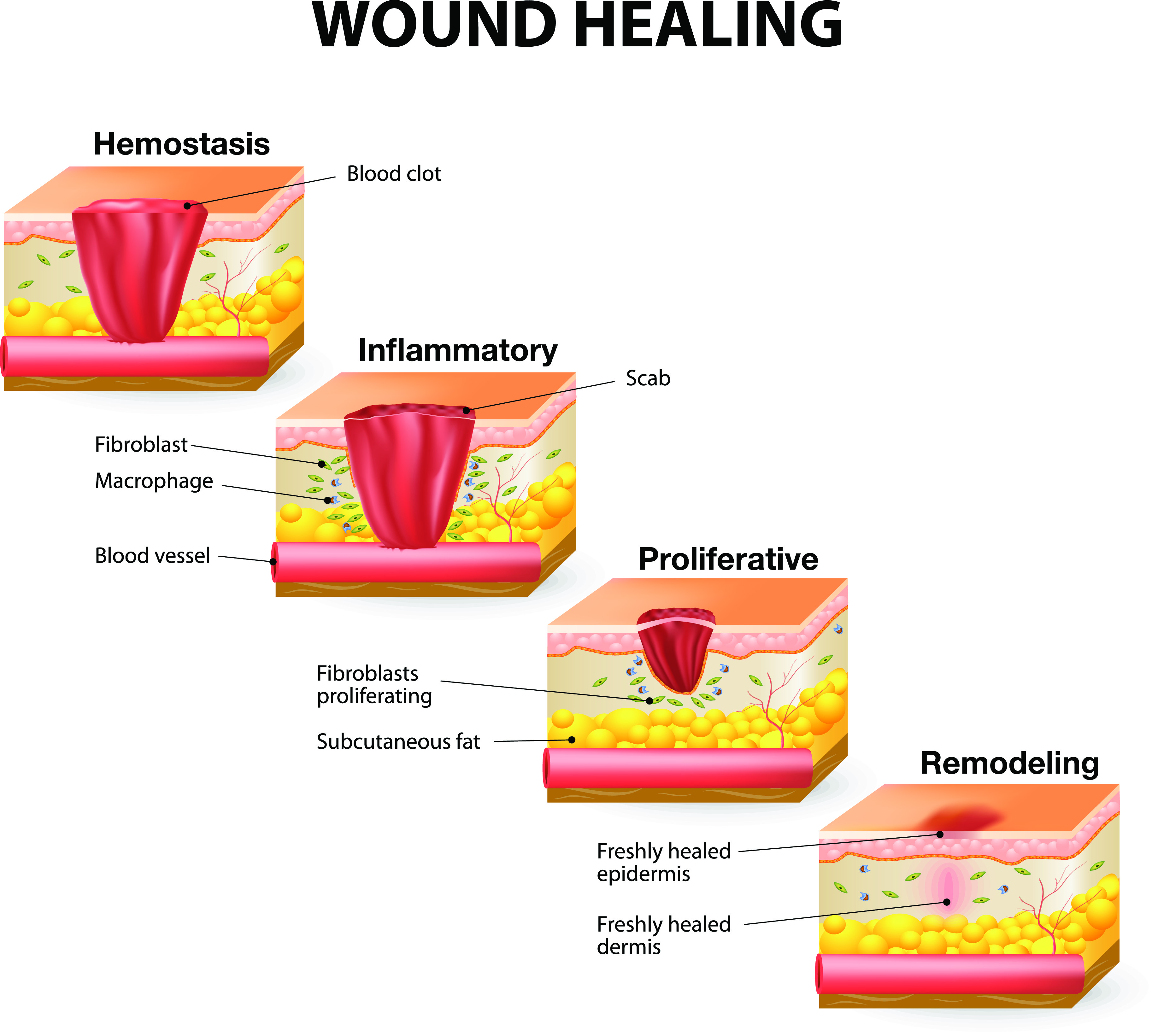 Diagnosis Of A Stages Of Wound Healing