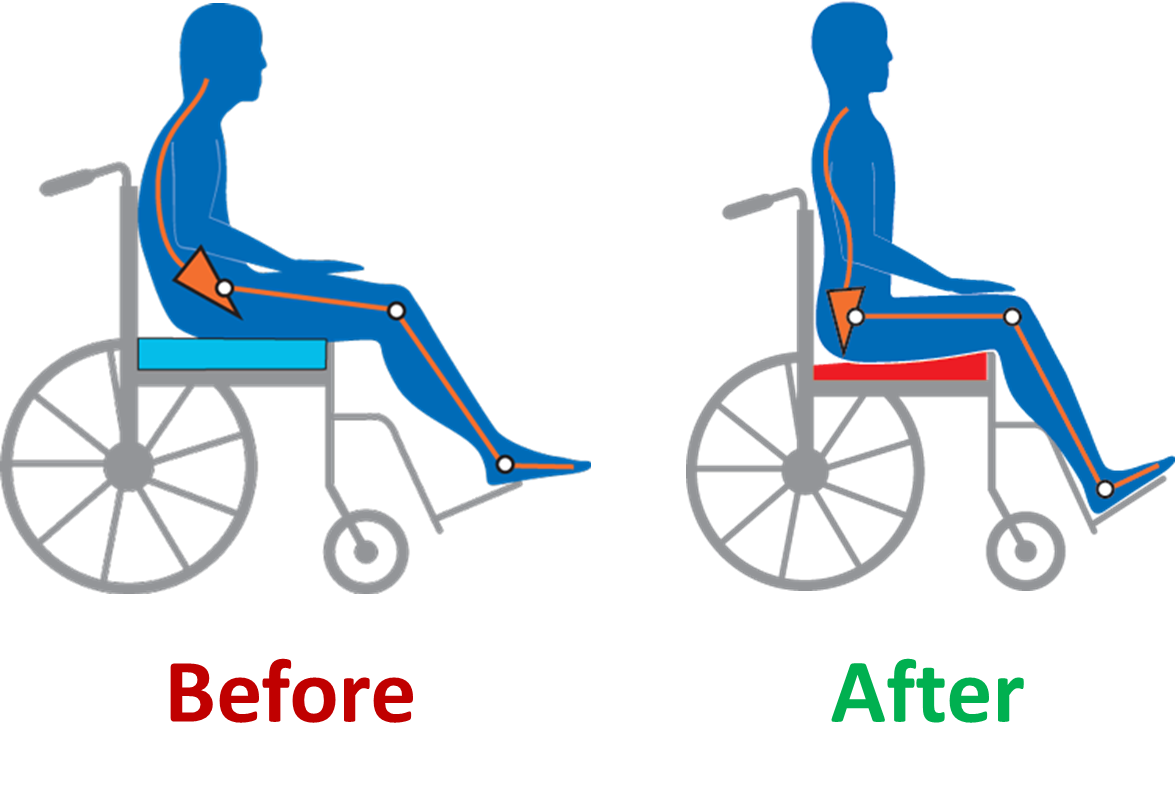 Turning And Repositioning Chart