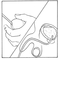 How to use an Intermittent Catheter 8