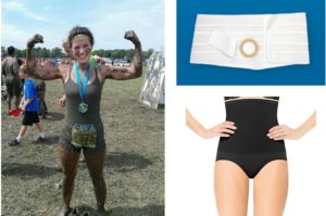 Exercising with an Ostomy