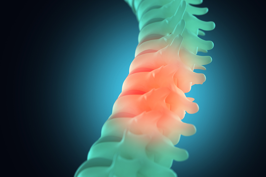 10 hechos sobre lesión de la médula espinal