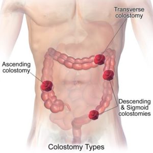 Overview of the GI Tract