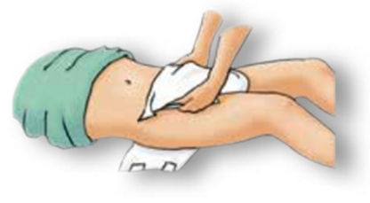 Change diaper bedridden sales patient