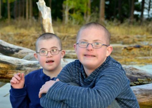 down syndrome and autism