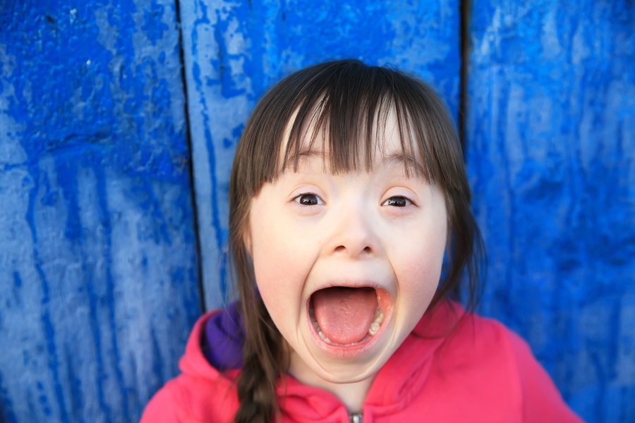 Down Syndrome: When Down Syndrome and Autism Collide | Shield