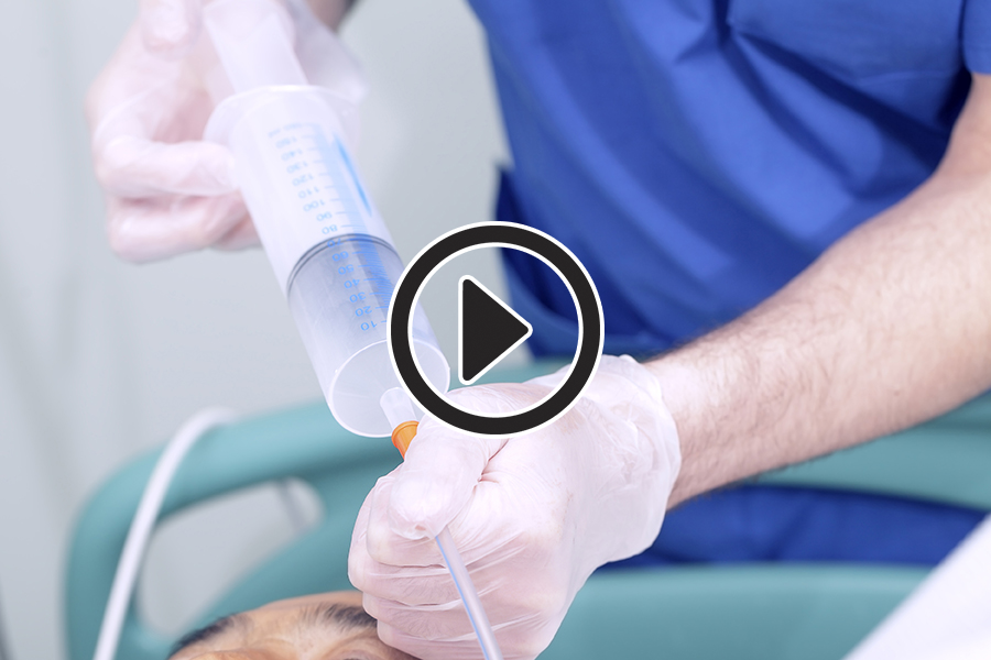 tube feeding