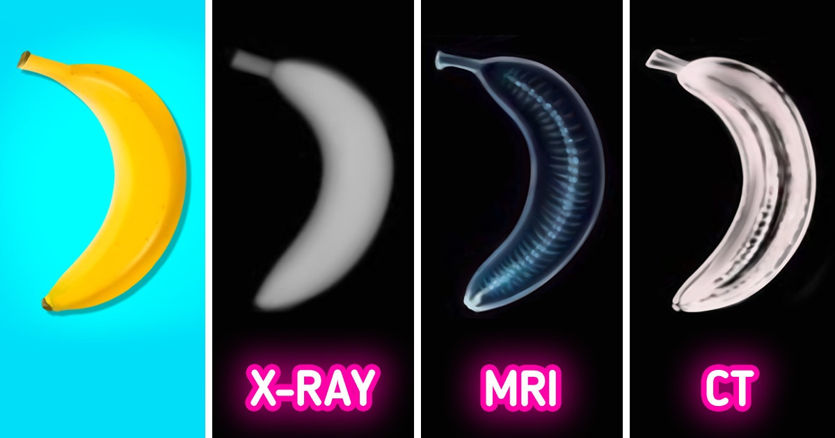 XRays, MRI Scans and CT Scans What’s t... Shield HealthCare