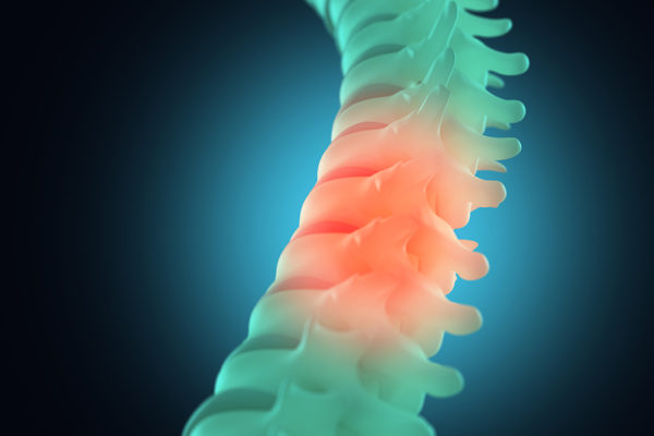 10 hechos sobre lesión de la médula espinal