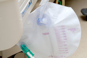 a semi-transparent, empty round night drain bag is hanging from the corner of a hospital bed in this guide to catheter accessories.