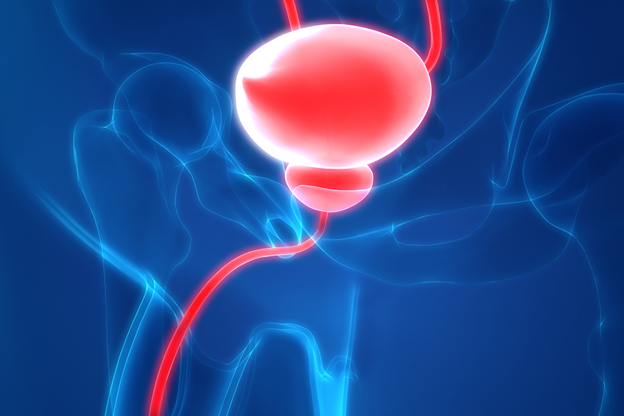 Common Incontinence Terms