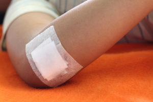Treatment Modalities