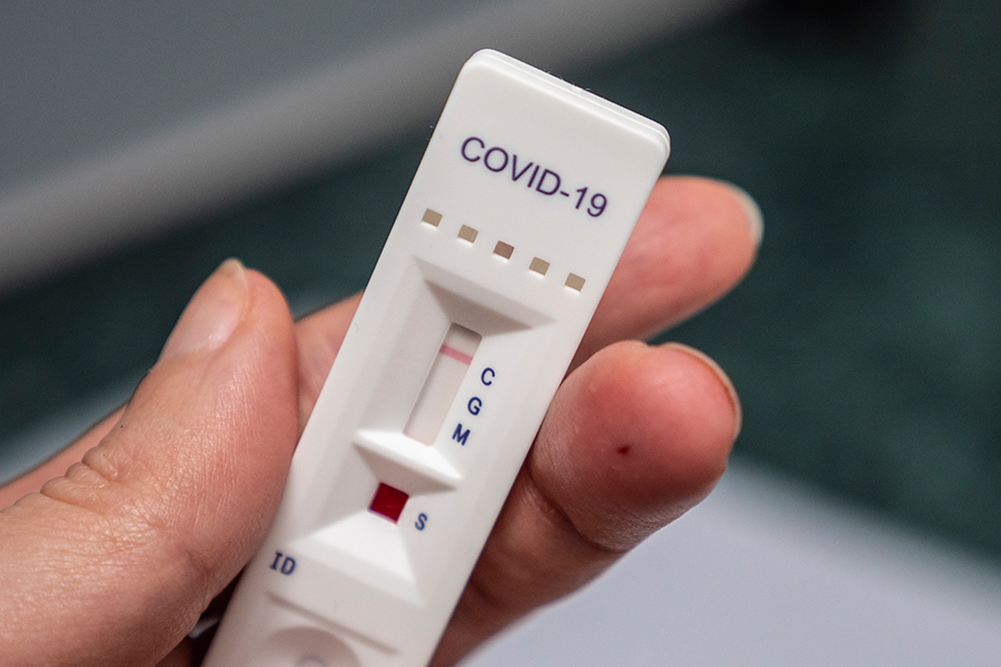 Coronavirus Antibody test